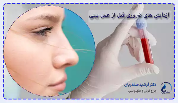 آزمایش های ضروری قبل از عمل بینی