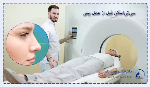 سی‌تی‌اسکن قبل از عمل بینی