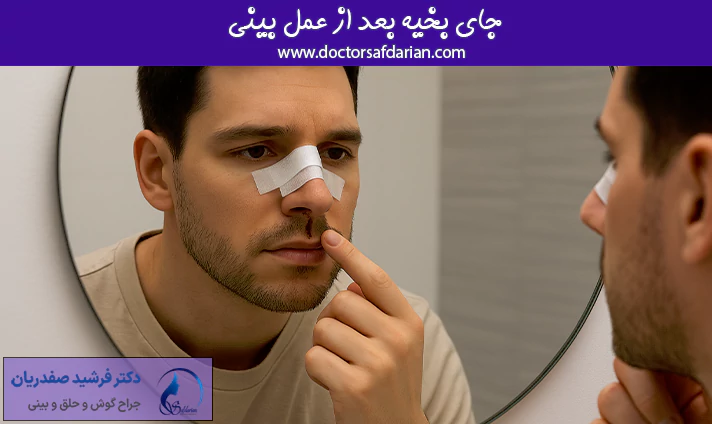 جای بخیه بعد عمل بینی