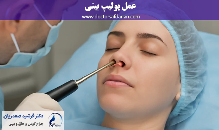 عمل پولیپ بینی