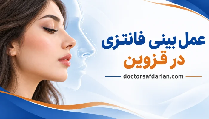 عمل بینی فانتزی در قزوین با فرم ظریف و قوس بینی