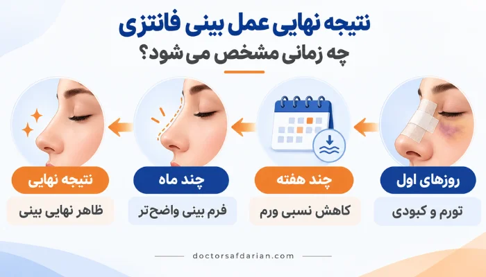 - زمان مشخص شدن نتیجه نهایی عمل بینی فانتزی و کاهش تورم