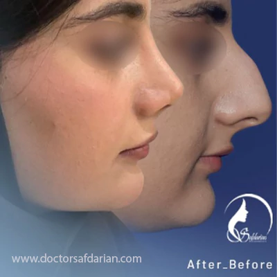 نمونه کار عمل بینی