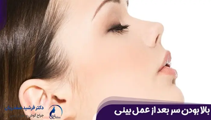 بالا بودن سر بعد از عمل بینی
