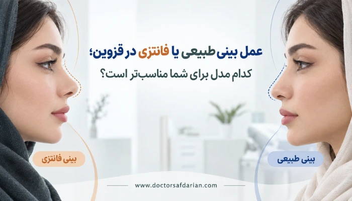 مقایسه عمل بینی طبیعی یا فانتزی در قزوین