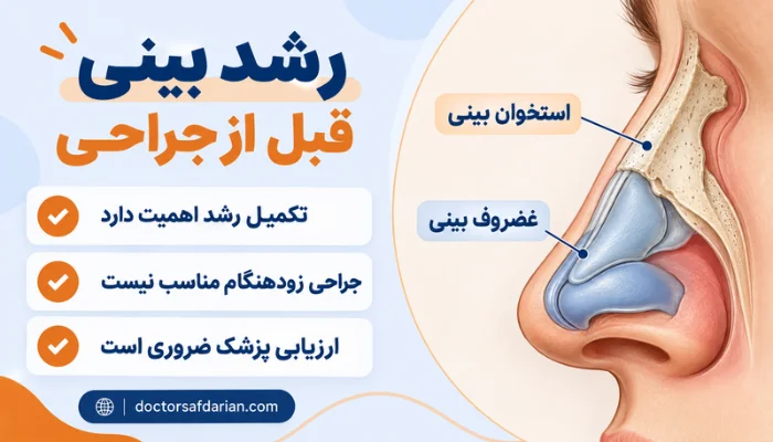 رشد استخوان و غضروف بینی قبل از جراحی